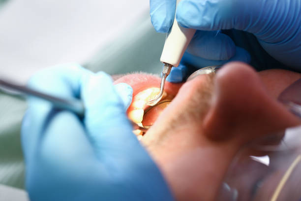 Best Pediatric Emergency Dentist in Tashua, CT