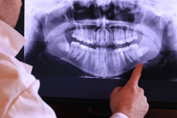 Best Emergency Dentist for Knocked-Out Tooth in Tashua, CT